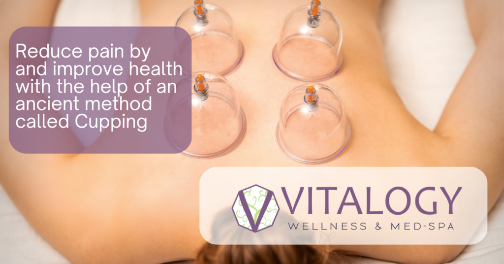 Cupping is an ancient method to improve circulation and chronic pain. It is a form of massage therapy