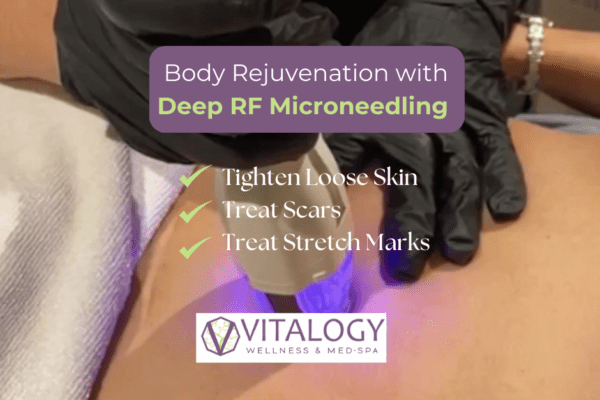Unveiling the Magic of Deep RF at Vitalogy Wellness and Med-Spa in Homewood, Alabama