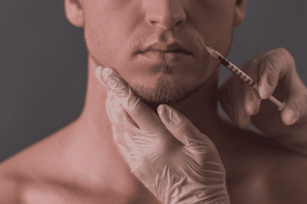 Trending in Aesthetics and Dermal Filler for Men
