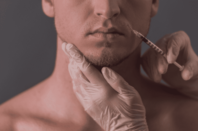 Trending in Aesthetics and Dermal Filler for Men