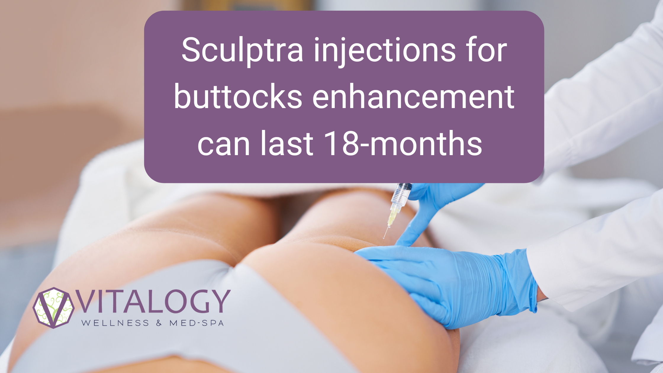 Sculptra injections for buttocks enhancement can last 18-months