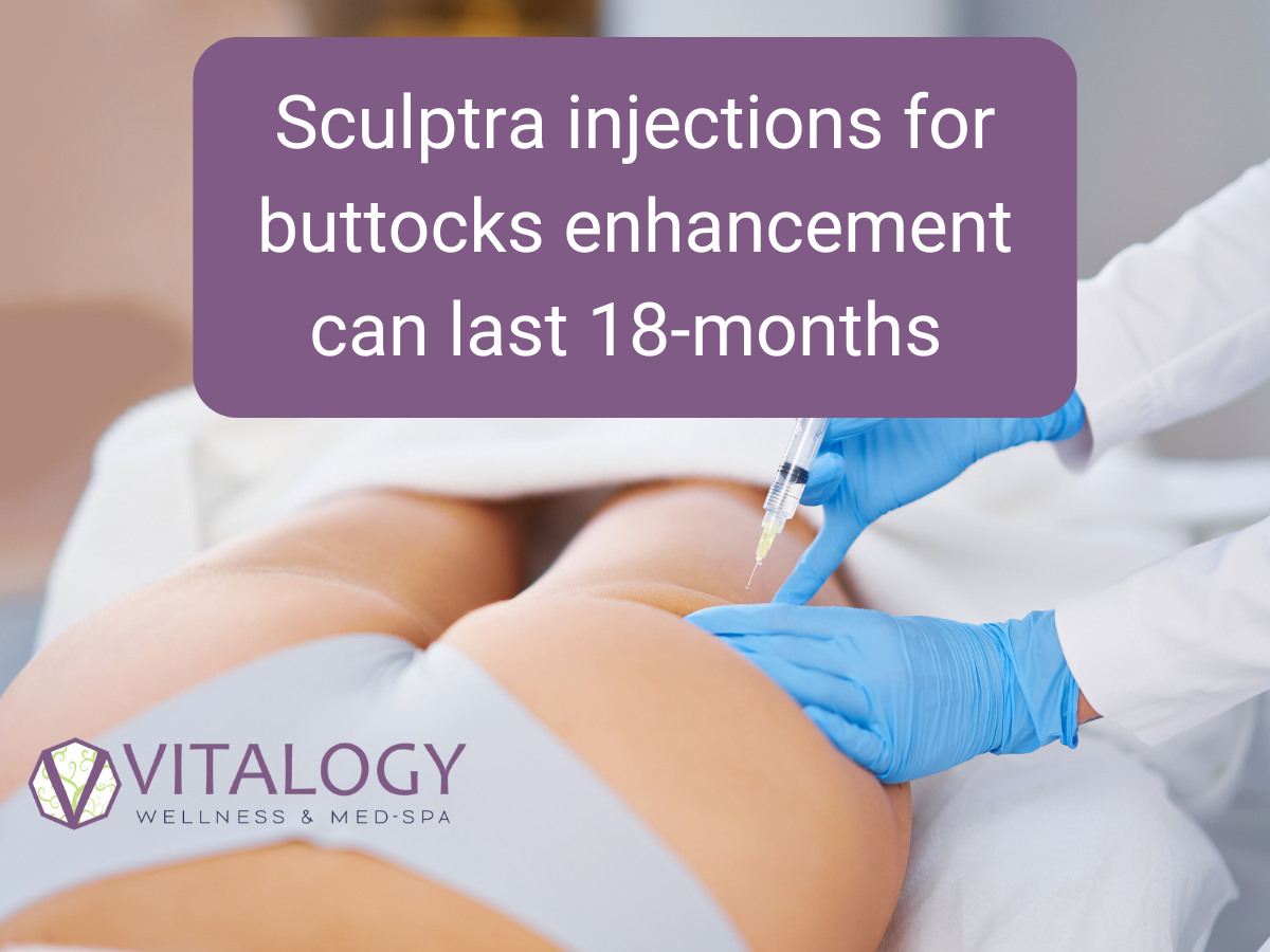 Sculptra injections for buttocks enhancement can last 18-months