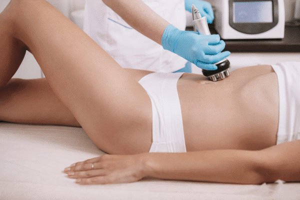 Noninvasive Skin Tightening with EXO|E and Virtue RF in Homewood, Alabama