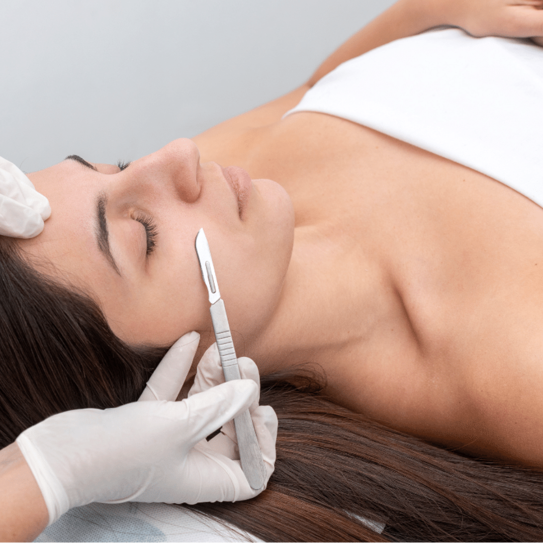 Dermaplaning at Vitalogy Wellness and Med Spa