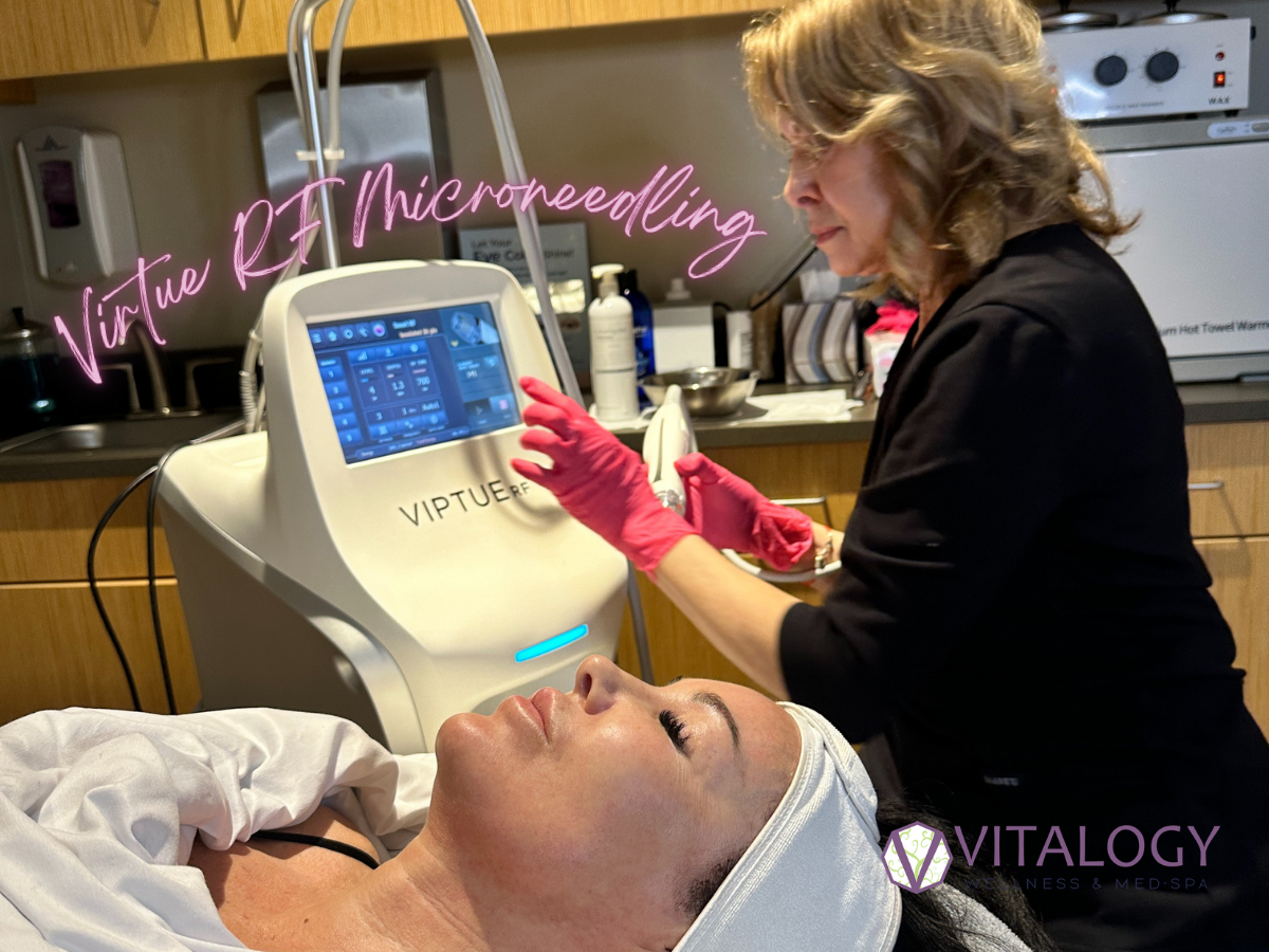 Virtue RF at Vitalogy Wellness and Med Spa Virtue RF at Vitalogy Wellness and Med Spa